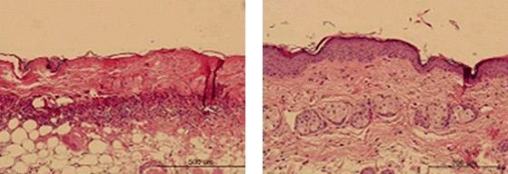 Princeton Junction healite before and after - microscopic view of skin